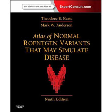 Atlas of Normal Roentgen Variants That May Simulate Disease: Expert Consult - Enhanced Online Features and Print, 9e