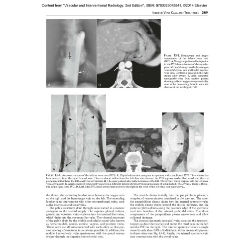 Vascular and Interventional Radiology: The Requisites, 2e (Requisites in Radiology) 2