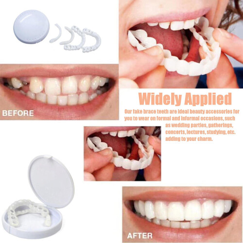 Upper Fake Teeth Simulation Braces Durable Tooth Cover And Lower False White Tools Healthy Creative Smiling Veneers 2