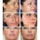 Ibealee Cream Remove Melasma Cream Remove S Melanin Melasma Remover Skin 3