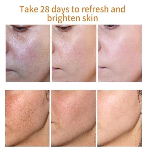 Ibealee Cream Remove Melasma Cream Remove S Melanin Melasma Remover Skin 1