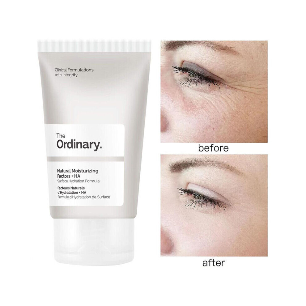 The Ordinary Natural Moisturizing Factors + HA Anti-aging Anti-wrinkle Facial Skin Care Cream