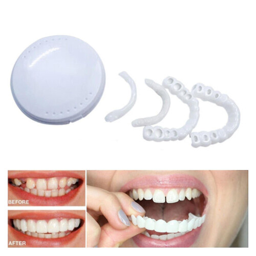 Snap On Upperbottom Set False Teeth Dental Veneers Denture Tooth Cover In Stock