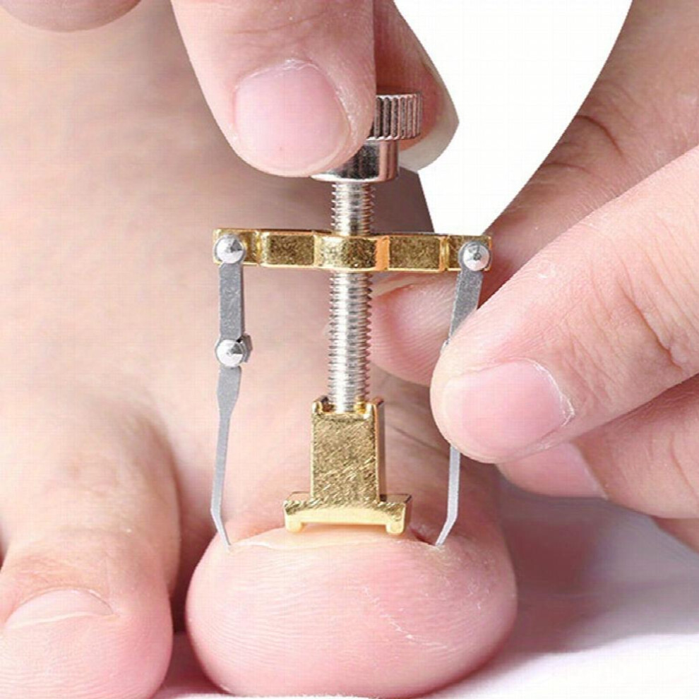Ingrown Toenail Correction Straightening Clip Toe Nail Correction Pedicure Foot Care