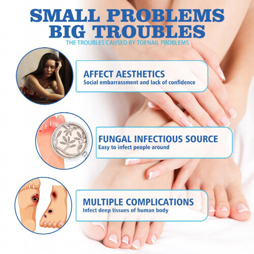 Nail Strength Balm Extra Strong Finger Toe Moisturizing Nail Cream For Thickened Nails 2