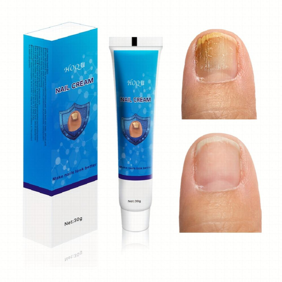 Toe Moisturizing Thickening Care Nail Toenail Daily Care Foot Spa Special-image-OPC-PDH6MMG-NEW