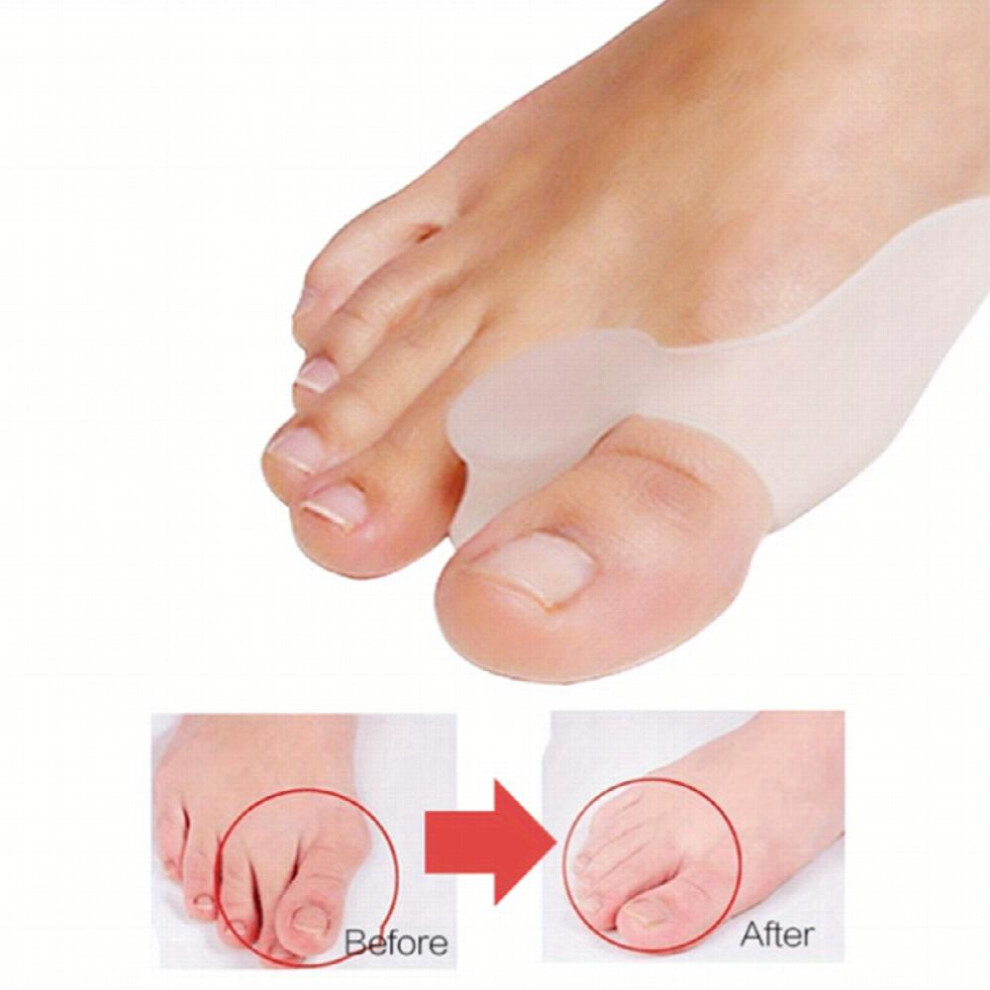 2pcs Toe Separators For Overlapping Toes Women Bunion Corrector Toe Spacers Bunion Relief Big Toe Cushion Pads Big Toe Spreader Orthopedic Bunion Brac
