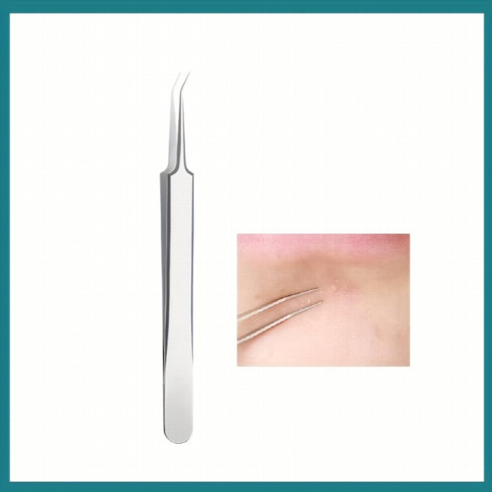 Professional Blackhead and Whitehead Remover Tweezers Effectively Remove Acne Blemishes and Pimples