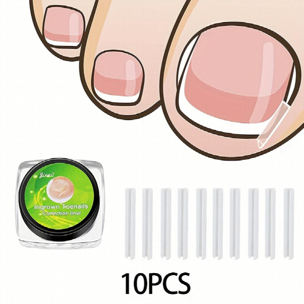 10 20 Pcs Ingrown Toenail Corrector Strips Foot Corrector Straightener Clip Curved Brace Toenails Thick Correction Foot Tool Nail Art Sets