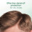 Head & Shoulders Head & Shoulders Anti dandruff Shampoo, Soothing Hydration Sulphate 4
