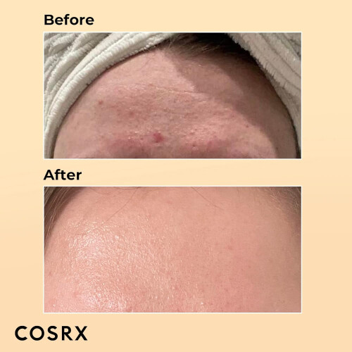 Cosrx COSRX Advanced Snail 96 Mucin Power Essence 100ml Skin Repair & Hydrating Serum, Snail Secretion Filtrate 96% & Hyaluronic acid Korean Skincare 2