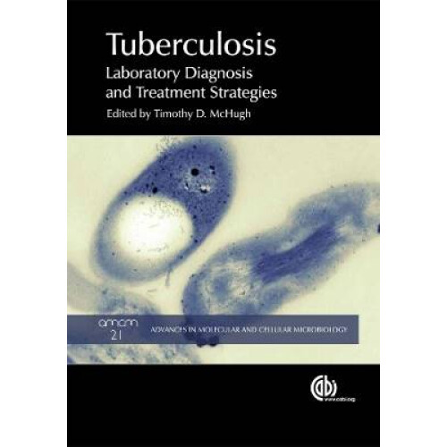 Tuberculosis Diagnosis and Treatment