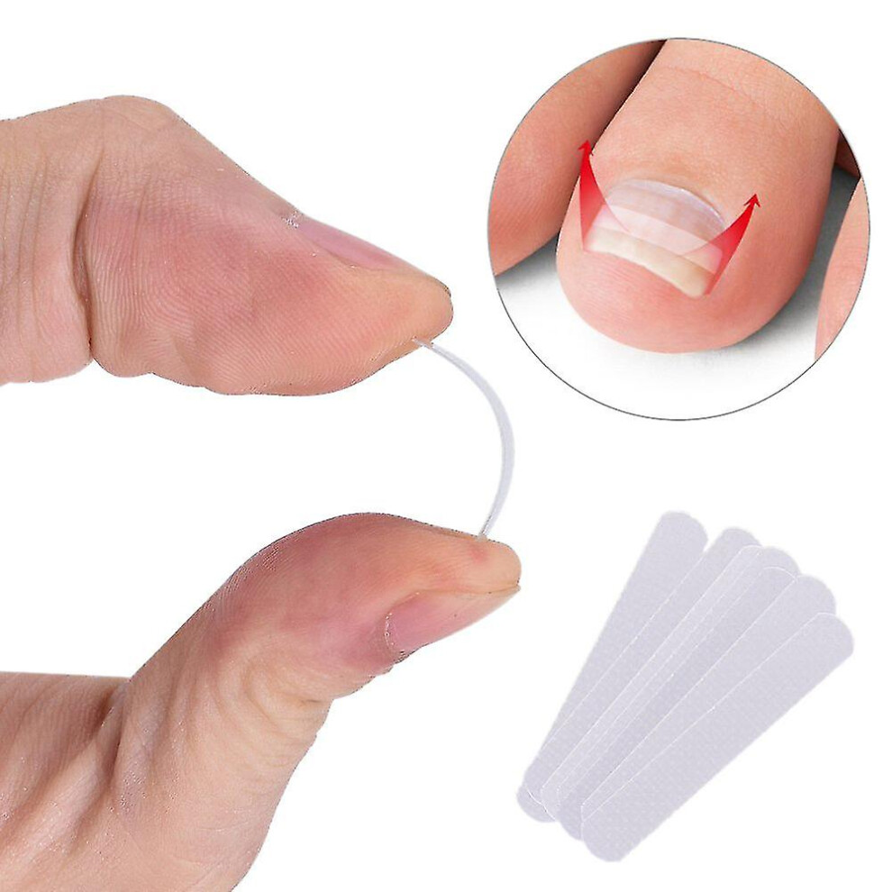 Ingrown Toenail Pedicure Tool 10pcs/ Straightening Clip Curved Bs Brace Toenails Thick Paronychia