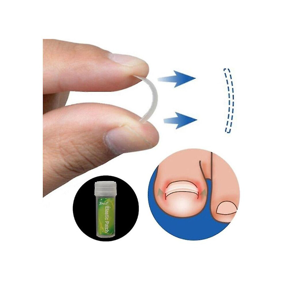 Professional 6pcs/set Ingrown Straightening Patch Foot Care Kit Nail Corrector