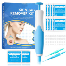 (blue) Natural Painless Auto SKIN TAG Removal Kit Skin Tag Micro Bands Remover Device
