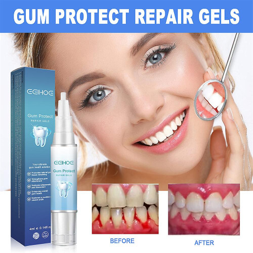 3pcs Gum Shield-therapy Gel 2