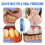 3pcs Gum Shield-therapy Gel 5