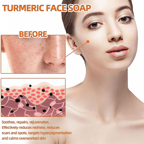 Natural Turmeric Soap Bar For Face 2
