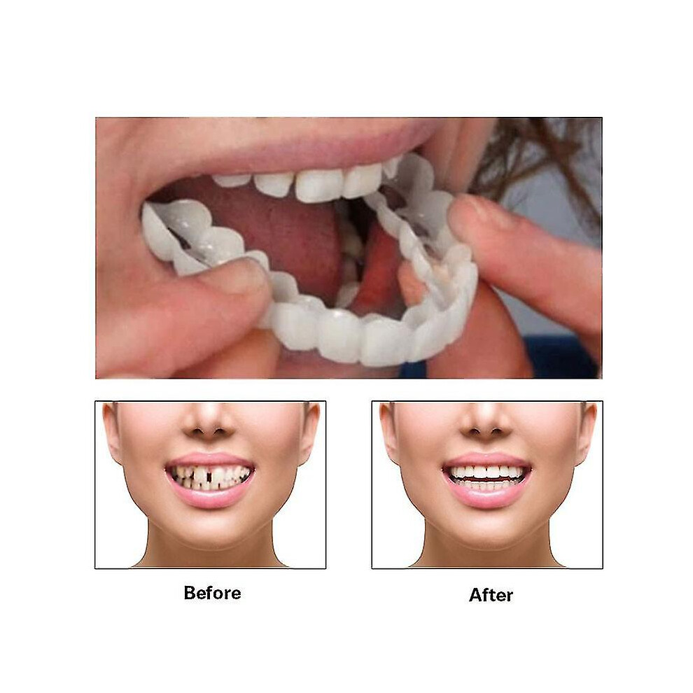 2 Piece Upper And Lower Premium Dentures Instant Smile Comfort Fit Elastic Cosmetic Teeth Denture Top