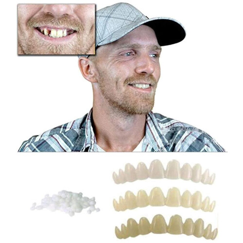 3pcs Temporary Tooth Replacement Kit - Quick Missing Tooth Fix for Front or Back Teeth, Dental Repair for Adults (ABS) 2