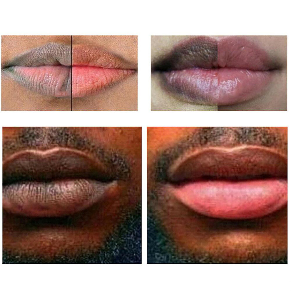 Lip Lightening Scrub Balm Lightens Dark Lips Moisturizing Repair Anti-aging Brightening Hyaluronic Acid