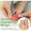 10 pack of toe caps Closed toe surface fabric sleeve protector with gel lining (large + medium) 4