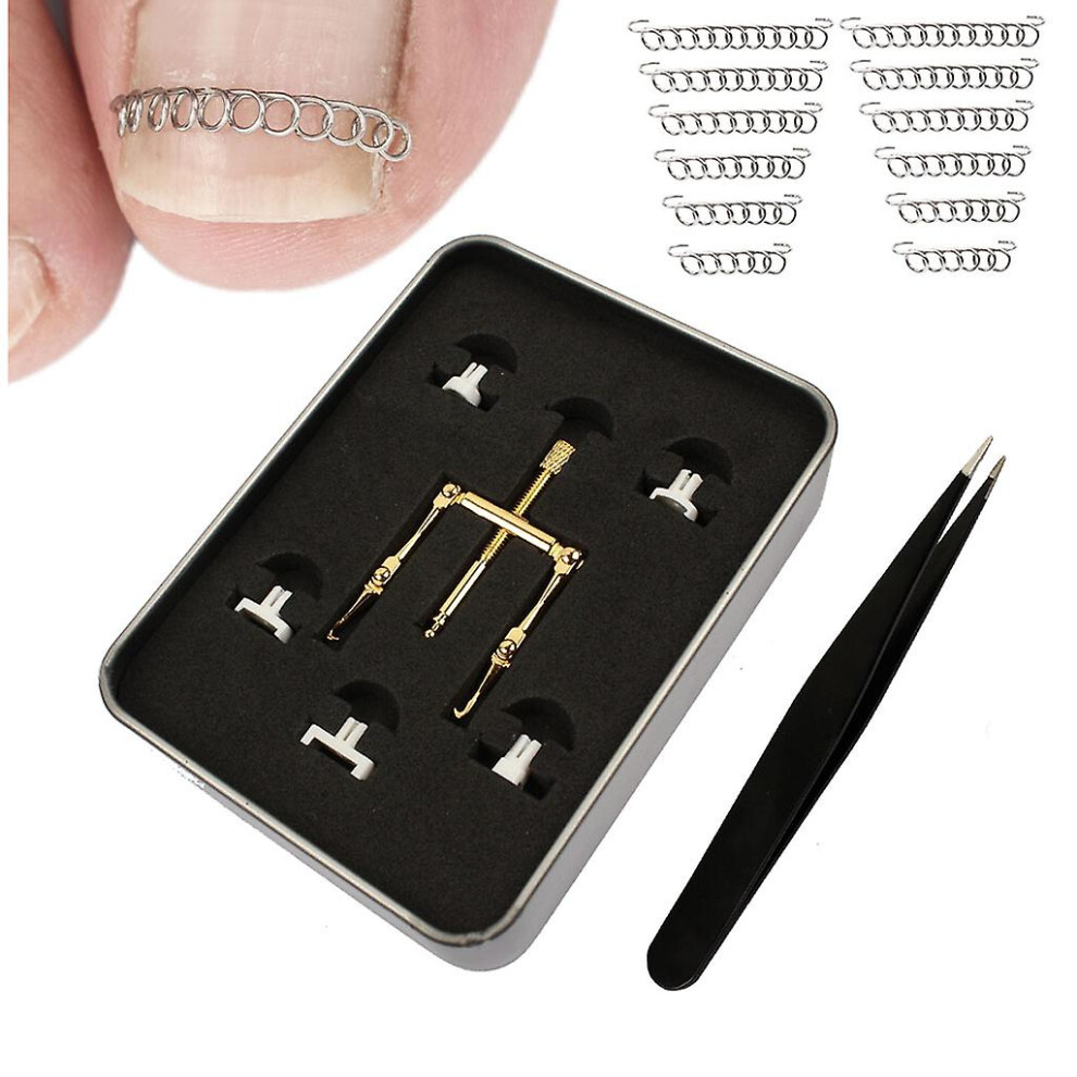 Ingrown Toenail Treatment Kit Paronychia Corrector Ingrown Toenail Corrector
