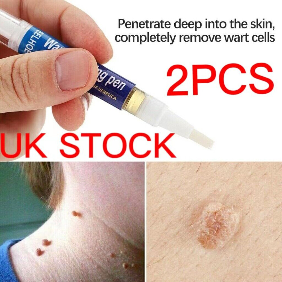 2PCS 12 Hours Wart Remover Pen Skin Tag Mole Remover
