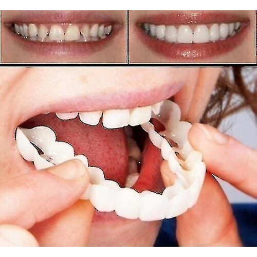 High-quality Denture Instant Smile Comfort Fit Flex Cosmetic Teeth - Upper