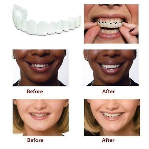High-quality Denture Instant Smile Comfort Fit Flex Cosmetic Teeth - Upper 2