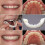 High-quality Denture Instant Smile Comfort Fit Flex Cosmetic Teeth - Upper 4