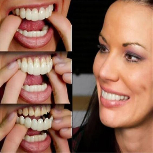 High-quality Denture Instant Smile Comfort Fit Flex Cosmetic Teeth - Upper 1