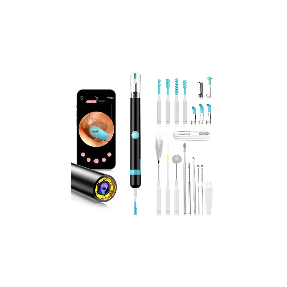 Ear Wax Removal Kit Camera, Upgraded Otoscope Earwax Removal Kit with 7 Massage Functions for Kids Adult Pet, 1080P FHD