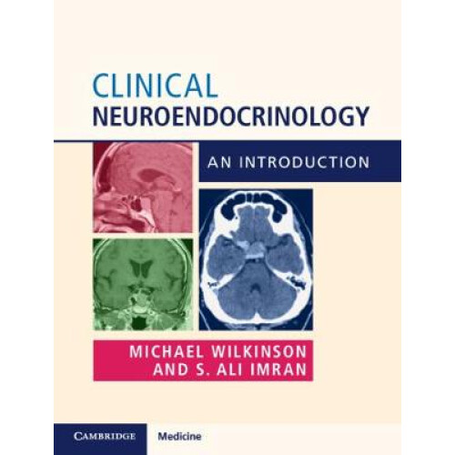 Clinical Neuroendocrinology An Introduction