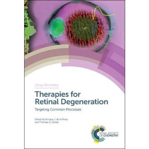 Therapies for Retinal Degeneration