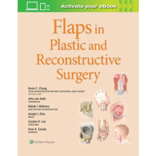 Flaps in Plastic and Reconstructive Surgery
