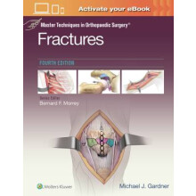 Master Techniques in Orthopaedic Surgery Fractures