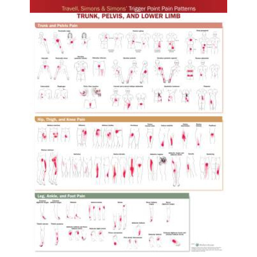 Travell, Simons & Simons' Trigger Point Pain Patterns Wall Chart