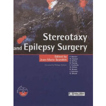 Stereotaxy Epilepsy Surgery