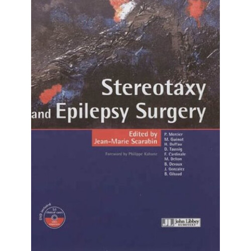 Stereotaxy  Epilepsy Surgery