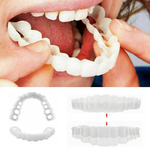 Smile Brace Snap On Upper False Teeth Dental Veneers Denture Cover Set