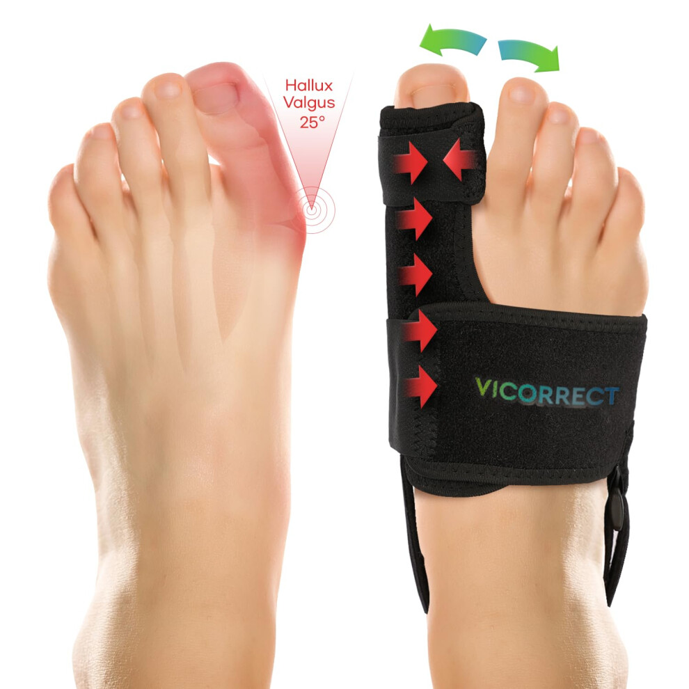 Bunion Corrector for Women and Men: Orthopedic Bunion Splint - Big Toe Straightener - Non-Surgical Hallux Valgus