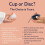 Pixie Soft Menstrual Disc - Ranked 1 for Most Soft Reusable Period Disc - Removable Stem - Wear for 12 Hours - 9