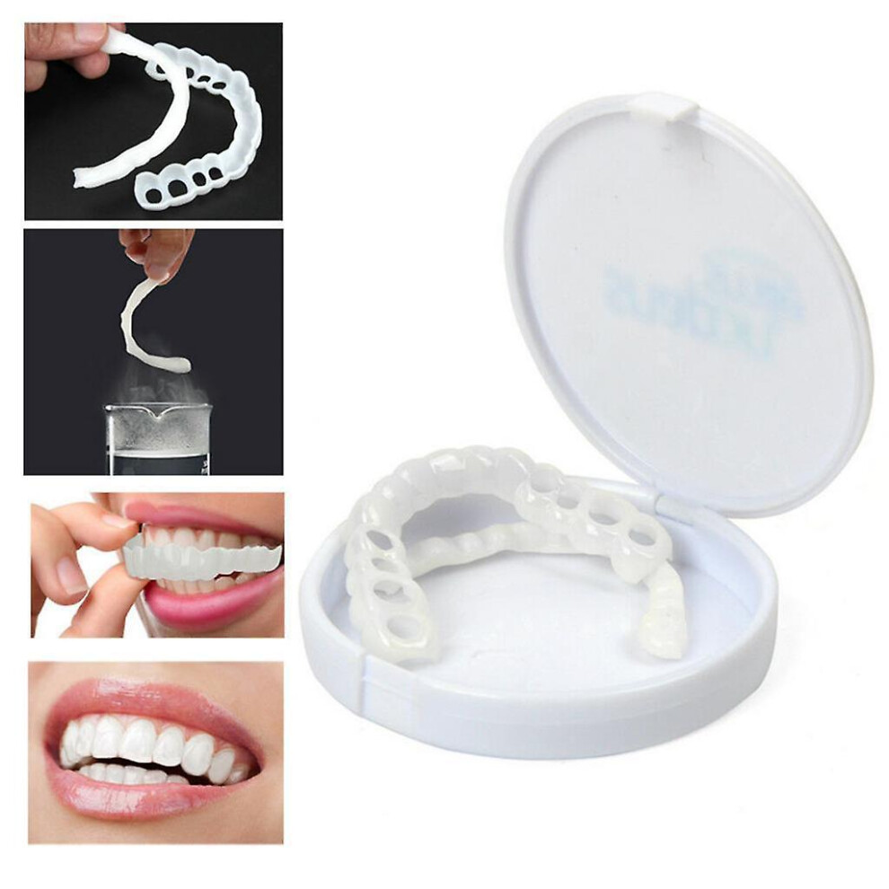 Instant   Teeth Veneers   Upper