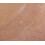 Hydrocolloid Dressing Large Size Selection (15x15cm x 5) 8