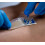 Hydrocolloid Dressing Large Size Selection (15x15cm x 5) 5