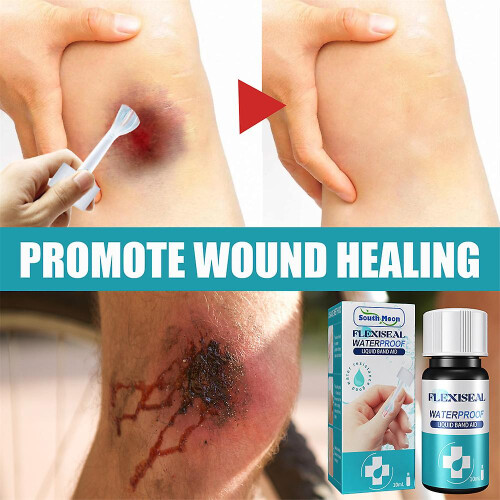 Medical Glue For Cuts, Fast-drying 1