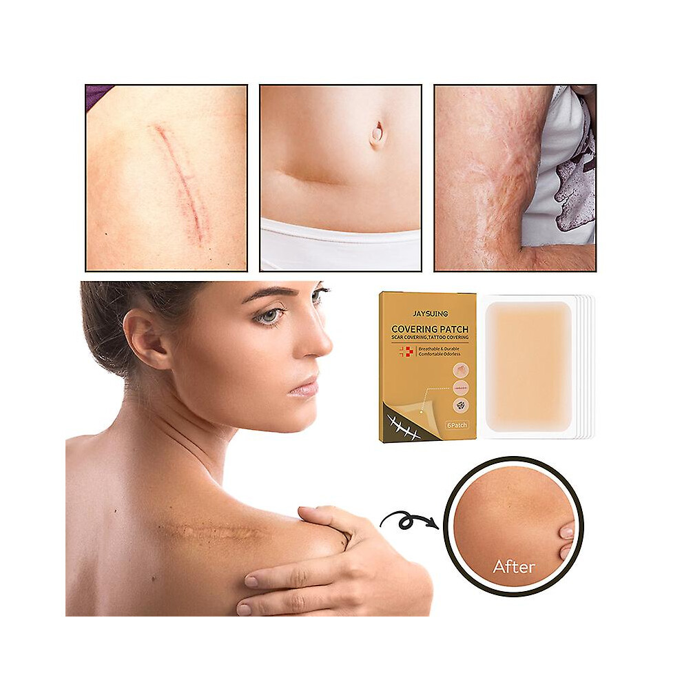 Skin Invisible Concealer Patch Sticker Breathable Tattoo Scar Cover Waterproof
