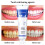 2023 New Sp-4 Probiotic Toothpaste, Yayashi Sp-4 Toothpaste Whitening 2