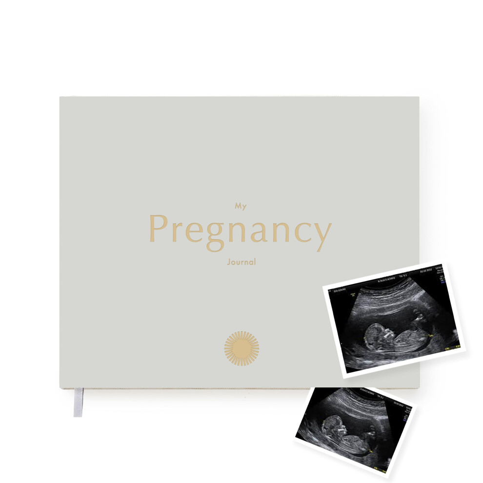 Your Edition Pregnancy Journal - Baby Memory Book For Expecting Mums - Luxury Pregnancy Book - Planner Pregnancy Gift For First Time Parents With Mål Paper
